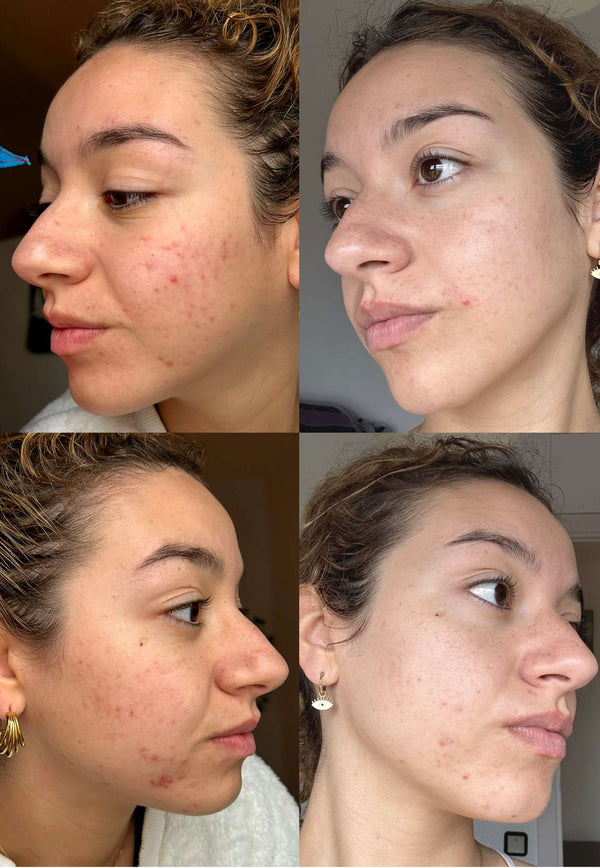 Anaïs rubio montero